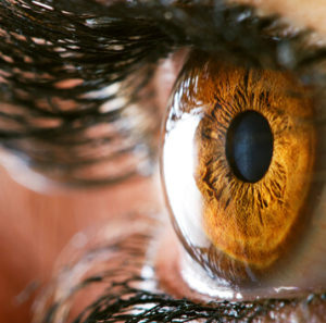 Torn Retina